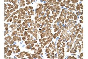Tropomyosin 2 antibody was used for immunohistochemistry at a concentration of 4-8 ug/ml to stain Skeletal muscle cells (arrows) in Human Muscle. (TPM2 Antikörper)