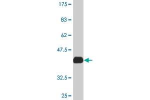 Western Blot detection against Immunogen (37. (MAPK6 Antikörper  (AA 612-721))