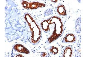 Image no. 2 for anti-Keratin 18 (KRT18) antibody (ABIN6179389) (Cytokeratin 18 Antikörper)