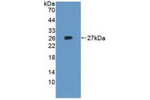 Detection of Recombinant RPL23A, Human using Polyclonal Antibody to Ribosomal Protein L23A (RPL23A) (RPL23A Antikörper  (AA 2-156))