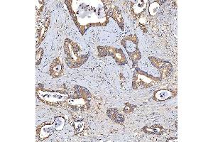 IHC analysis of TTLL2 using anti-TTLL2 antibody (ABIN7600850).