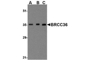 Image no. 1 for anti-BRCA1/BRCA2-Containing Complex, Subunit 3 (BRCC3) (N-Term) antibody (ABIN318911) (BRCC3 Antikörper  (N-Term))