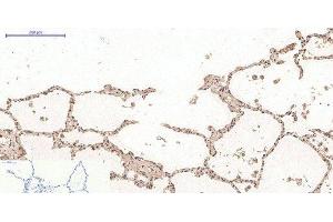 Immunohistochemistry of paraffin-embedded Human lung tissue using Desmin Monoclonal Antibody at dilution of 1:200. (Desmin Antikörper)