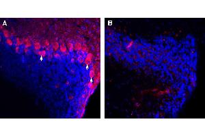 Expression of TRPC3 in rat cerebellum.