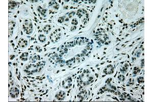 Immunohistochemical staining of paraffin-embedded breast tissue using anti-GAD1 mouse monoclonal antibody.