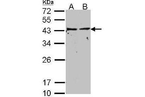 WB Image Sample(30 ug whole cell lysate) A: A431, B: HeLa S3, 12% SDS PAGE antibody diluted at 1:500 (GNAI1 Antikörper  (Center))