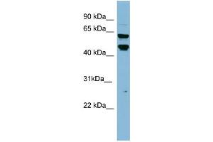 WB Suggested Anti-PH-4 Antibody Titration: 0. (P4HTM Antikörper  (Middle Region))