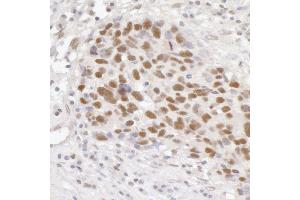 Immunohistochemistry (IHC) image for anti-General Transcription Factor IIIC, Polypeptide 5 (GTF3C5) (AA 469-519) antibody (ABIN7454732)