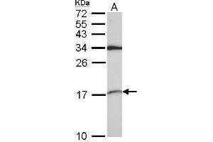 WB Image Sample (30 ug of whole cell lysate) A: A549 15% SDS PAGE antibody diluted at 1:1000 (SNRPD2 Antikörper)