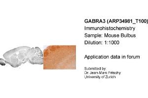 Immunohistochemistry (IHC) image for anti-gamma-aminobutyric Acid (GABA) A Receptor, alpha 3 (GABRA3) (Middle Region) antibody (ABIN2776110) (GABRA3 Antikörper  (Middle Region))