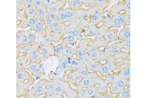 Immunohistochemistry of paraffin-embedded Mouse liver using ASGR1 Polyclonal Antibody at dilution of 1:100 (40x lens). (Asialoglycoprotein Receptor 1 Antikörper)