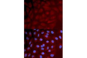 Immunofluorescence analysis of U2OS cell using IRF3 antibody. (IRF3 Antikörper)