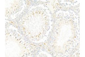 ABIN7094885 and ABIN7098938 at 1/100 staining Rat testis tissue by IHC-P.