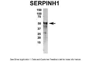 IP Suggested Anti-SERPINH1 Antibody Positive Control: NT2 CELL/BRAIN TISSUE (SERPINH1 Antikörper  (C-Term))