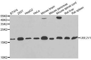 Western Blotting (WB) image for anti-Ubiquitin-Conjugating Enzyme E2 Variant 1 (UBE2V1) antibody (ABIN1980332) (UBE2V1 Antikörper)