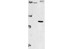 Western blot of chicken brain tissue incubated with CLC4 Antibody (C-term). (CLCN4 Antikörper  (C-Term))