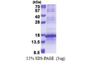 SDS-PAGE (SDS) image for Ribosomal Protein L35a (RPL35A) (AA 1-110) protein (His tag) (ABIN5853250)