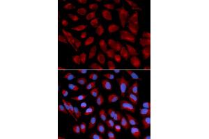 Immunofluorescence analysis of U2OS cells using AIFM1 antibody. (AIF Antikörper)