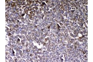 IHC testing of FFPE mouse liver tissue with VDBP antibody at 1ug/ml. (Vitamin D-Binding Protein Antikörper)