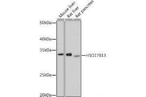 Western blot analysis of extracts of various cell lines using HSD17B13 Polyclonal Antibody at dilution of 1:1000. (HSD17B13 Antikörper)