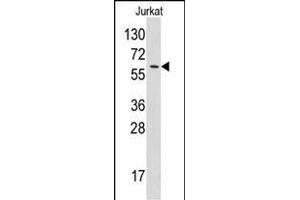 Western blot analysis of anti-YARS Pab (ABIN391838 and ABIN2841677) in Jurkat cell line lysates (35 μg/lane). (YARS Antikörper  (N-Term))