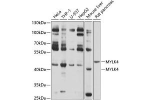 Western blot analysis of extracts of various cell lines, using MYLK4 antibody (ABIN6133126, ABIN6144268, ABIN6144269 and ABIN6214097) at 1:1000 dilution. (MYLK4 Antikörper  (AA 119-388))