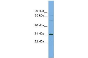 WB Suggested Anti-SLCO1B1 Antibody Titration: 0. (SLCO1B1 Antikörper  (Middle Region))