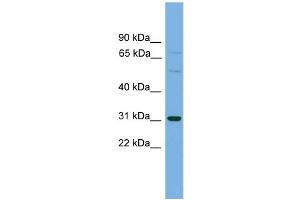 WB Suggested Anti-SLCO1B1 Antibody Titration: 0.