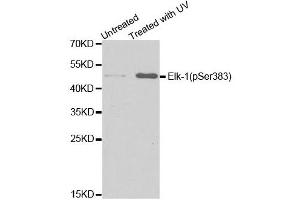 Western blot analysis of extracts from HT29 cells untreated or treated with UV, using Phospho-ELK1-S383 antibody (ABIN5969890). (ELK1 Antikörper  (pSer383))