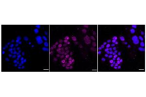 anti-Matrin 3 (MATR3) antibody
