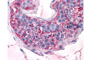 Anti-GPRC5A / RAI3 antibody IHC of human testis.