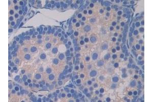 Immunohistochemistry (IHC) image for anti-Pyruvate Dehydrogenase Kinase, Isozyme 4 (PDK4) (AA 117-387) antibody (ABIN7439630)