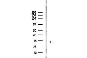 Western blot analysis of lysates from COLO205 cells(heat-shock, 45 min treatment), using MN Antibody at 1/1000 dilution.