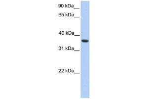 MAGEA4 antibody used at 1 ug/ml to detect target protein. (MAGEA4 Antikörper  (C-Term))