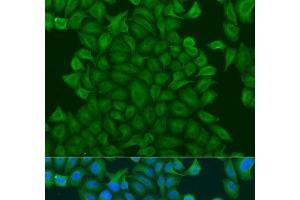 Immunofluorescence analysis of U2OS cells using GSTM3 Polyclonal Antibody at dilution of 1:100. (GSTM3 Antikörper)