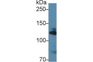 Western Blot; Sample: Human K562 cell lysate; Primary Ab: 1µg/ml Rabbit Anti-Mouse ADD1 Antibody Second Ab: 0. (alpha Adducin Antikörper  (AA 388-560))