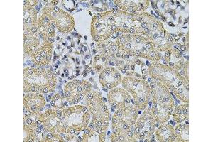 Immunohistochemistry of paraffin-embedded Rat kidney using AP2A1 Polyclonal Antibody at dilution of 1:100 (40x lens). (alpha Adaptin Antikörper)