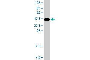 Western Blot detection against Immunogen (37 KDa) . (NEDD4-2 Antikörper  (AA 1-100))