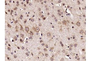 Immunohistochemistry (Paraffin-embedded Sections) (IHC (p)) image for anti-Ribosomal Protein S6 (RPS6) (AA 151-249) antibody (ABIN700885)