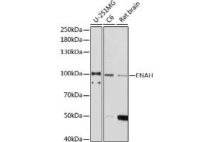 Western blot analysis of extracts of various cell lines, using ENAH antibody (ABIN7266936) at 1:1000 dilution. (ENAH Antikörper  (AA 412-591))