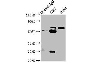 Immunoprecipitating CBS in Hela whole cell lysate Lane 1: Rabbit control IgG instead of ABIN7148965 in Hela whole cell lysate. (CBS Antikörper  (AA 1-413))