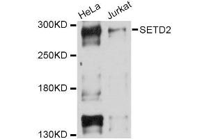 Western blot analysis of extracts of various cell lines, using SETD2 Antibody. (SETD2 Antikörper  (AA 803-1103))