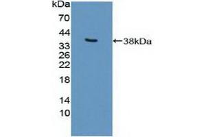 Detection of Recombinant EP300, Human using Polyclonal Antibody to E1A Binding Protein P300 (EP300) (p300 Antikörper  (AA 1351-1601))