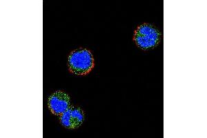 Confocal immunofluorescent analysis of KLRC1 Antibody (N-term) (ABIN656501 and ABIN2845775) with MDA-M cell followed by Alexa Fluor 488-conjugated goat anti-rabbit lgG (green). (KLRC1 Antikörper  (N-Term))