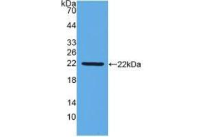 Western blot analysis of recombinant Chicken IFNb. (IFNB1 Antikörper  (AA 27-203))