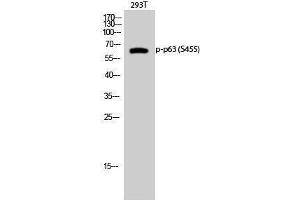 Western Blotting (WB) image for anti-T-Complex 1 (TCP1) (pSer455) antibody (ABIN3182583) (TCP1 alpha/CCTA Antikörper  (pSer455))