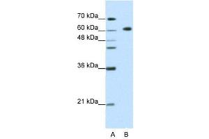 WB Suggested Anti-GMEB2  Antibody Titration: 1. (GMEB2 Antikörper  (C-Term))
