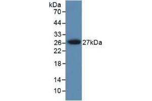 Figure. (PRSS1 Antikörper  (AA 51-228))