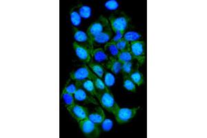IF analysis of TTK using anti-TTK antibody (ABIN7601844). (Mps1 Antikörper  (AA 487-821))
