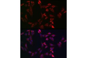 Immunofluorescence analysis of NIH-3T3 cells using Bid Rabbit pAb (ABIN3020687, ABIN3020688, ABIN3020689, ABIN1512634 and ABIN6213669) at dilution of 1:150 (40x lens). (BID Antikörper  (AA 1-130))